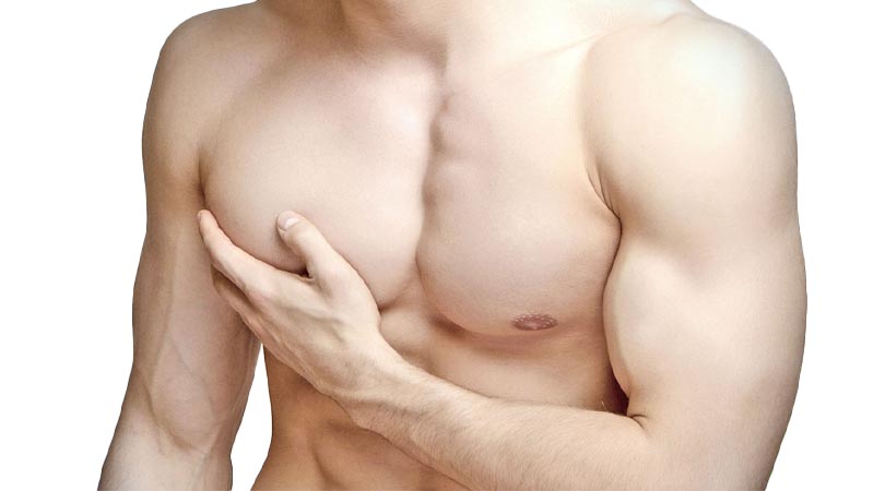 Gynecomastia Surgery