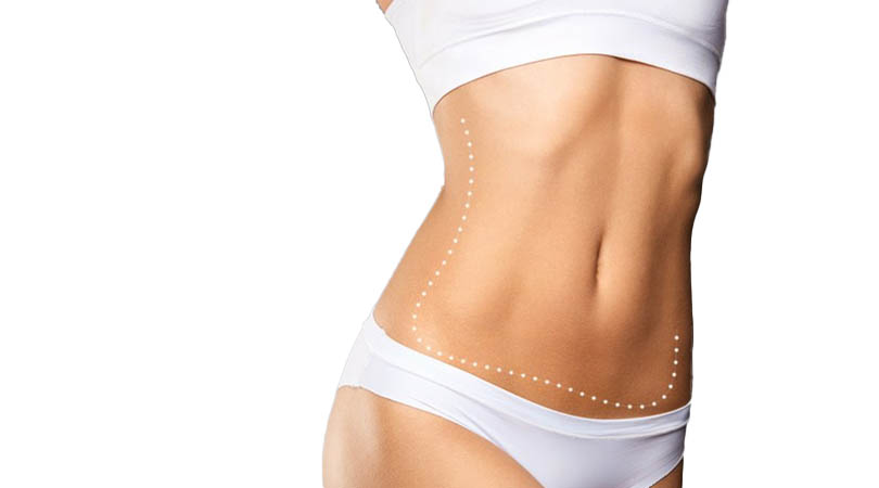 Tummy Tuck Surgery